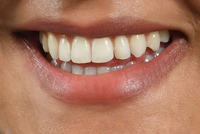 Bild für ästhetische Zahnmedizin
